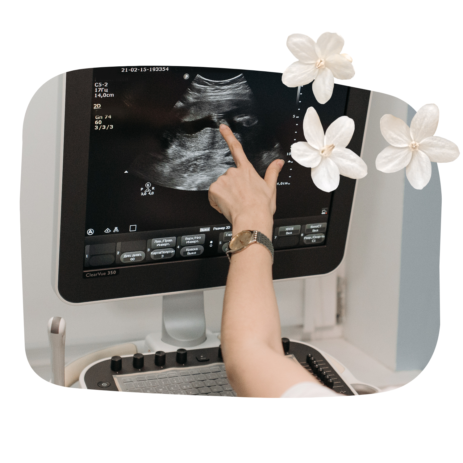 Ultrasound photo 3 CC