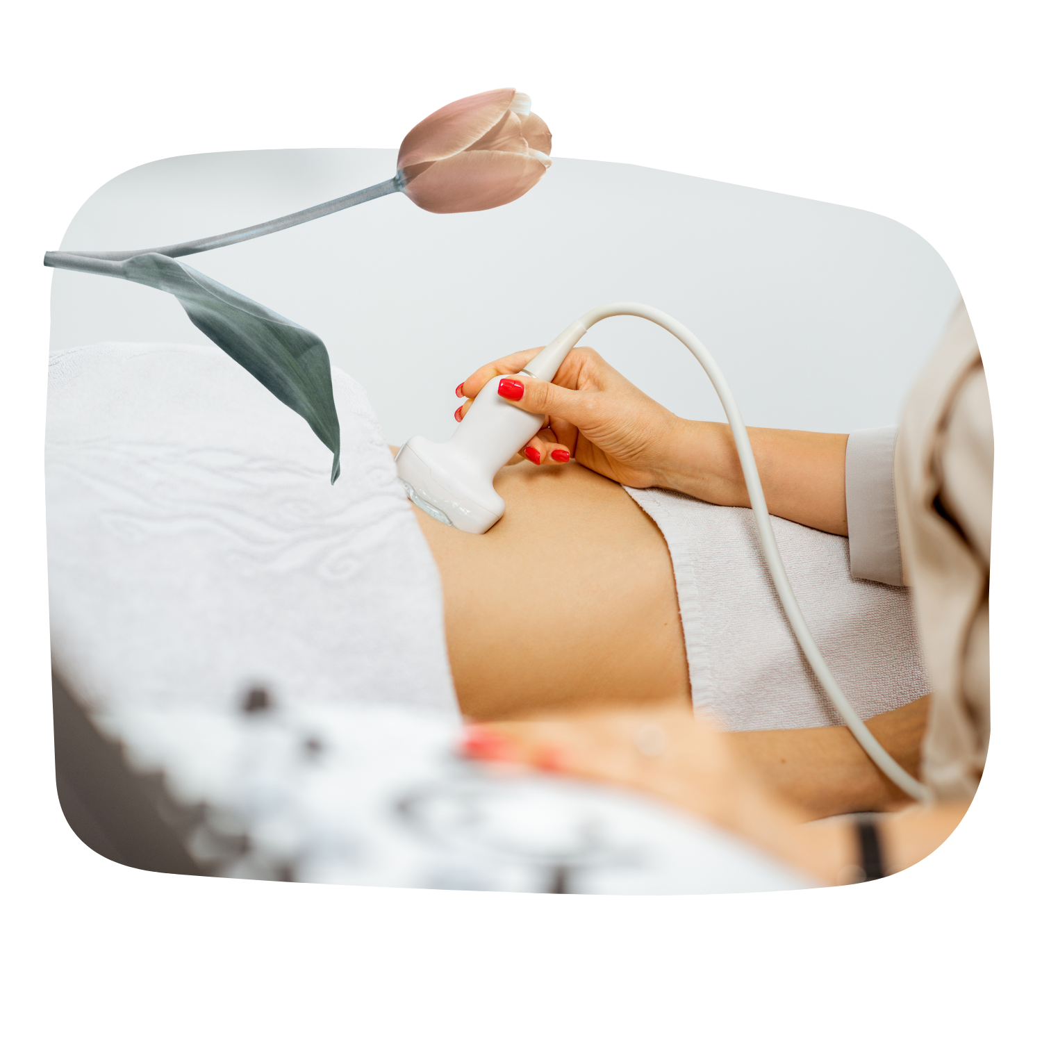 Ultrasound photo